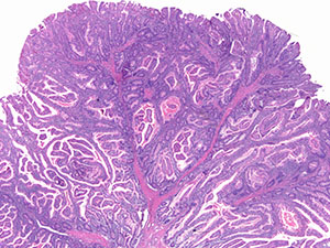 Gastrointestinal Pathology Slide Image