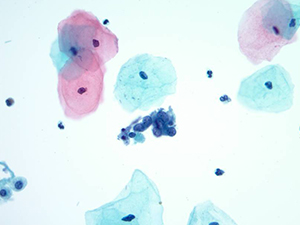 Cytopathology slide image