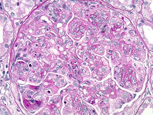 Medical Kidney Pathology slide image