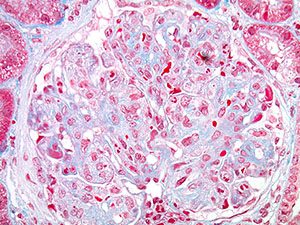 Medical Kidney Pathology slide image