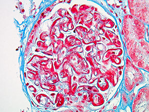 Medical Kidney Pathology slide image