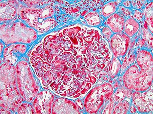 Medical Kidney Pathology slide image