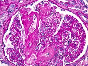 Medical Kidney Pathology slide image
