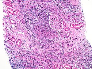 Medical Kidney Pathology slide image