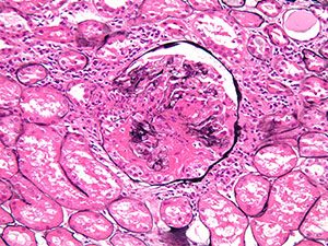 Medical Kidney Pathology slide image
