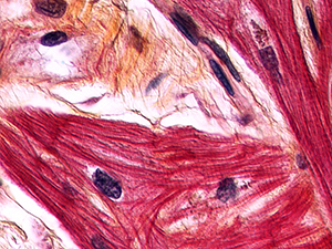 Slide image of heart tissue