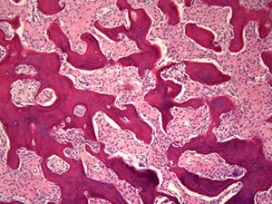 Soft Tissue Pathology slide image