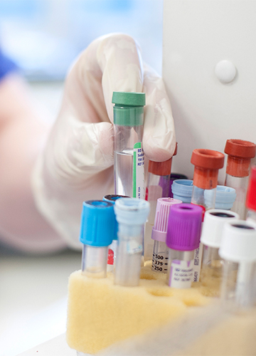 What Is Specimen Handling In A Clinical Pathology Lab? – ELACI